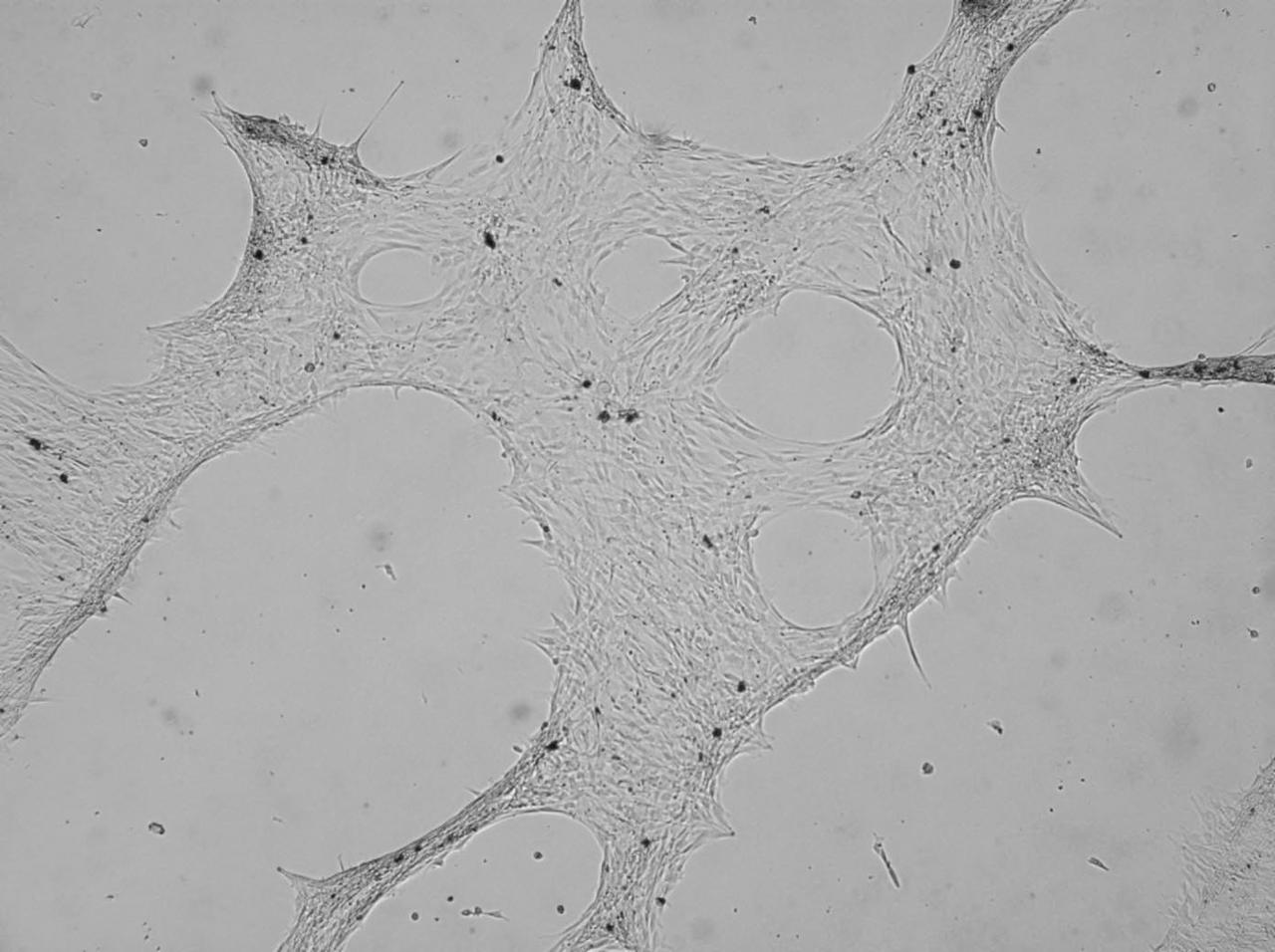 jsc2021e036650 (8/11/2021) --- A view of Osteogenesis-induced differentiation of human mesenchymal stem cells. REducing Arthritis Dependent Inflammation First Phase (READI FP) evaluates how microgravity and space radiation affect the generation of bone tissue. It also examines the potential protective effects of bio-collagen and bioactive metabolites such as antioxidants during spaceflight. The source of these metabolites are vegetal extracts produced as waste products in wine production.