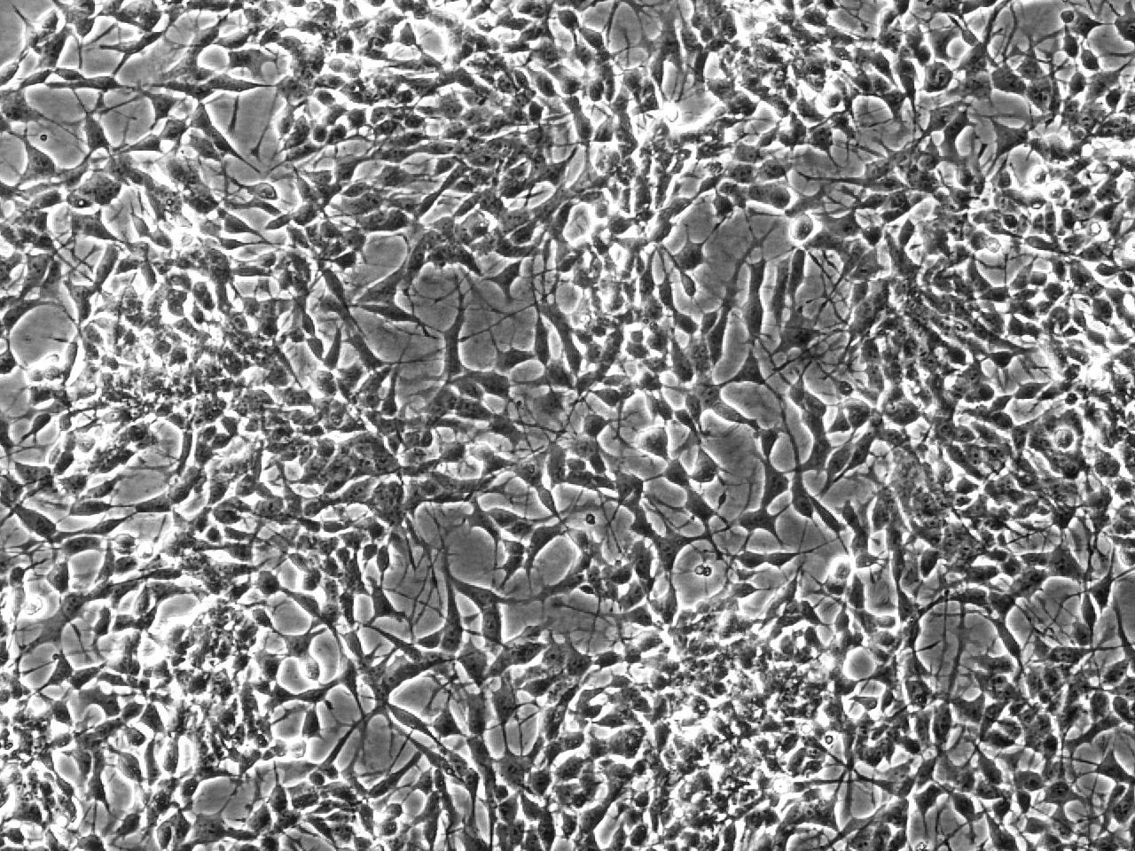 jsc2022e031232 (4/26/2022) --- A preflight view of differentiating neuron-like cell cultures with a dense network of neurites for intercellular interaction. The PROtection MEdiated by antioxidant nanoTEchnOlogy against neuronal damage in space (PROMETEO) (Antioxidant Protection) investigation proposes the use of biocompatible and biodegradable polydopamine-based nanoparticles to provide antioxidant protection to neurons undergoing exposure to altered gravity and cosmic radiation. Image courtesy of Istituto Italiano di Tecnologia.
