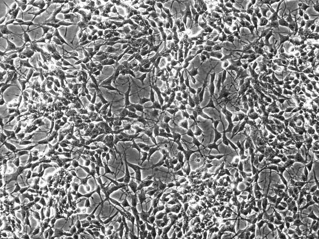 NASA image: Antioxidant Protection