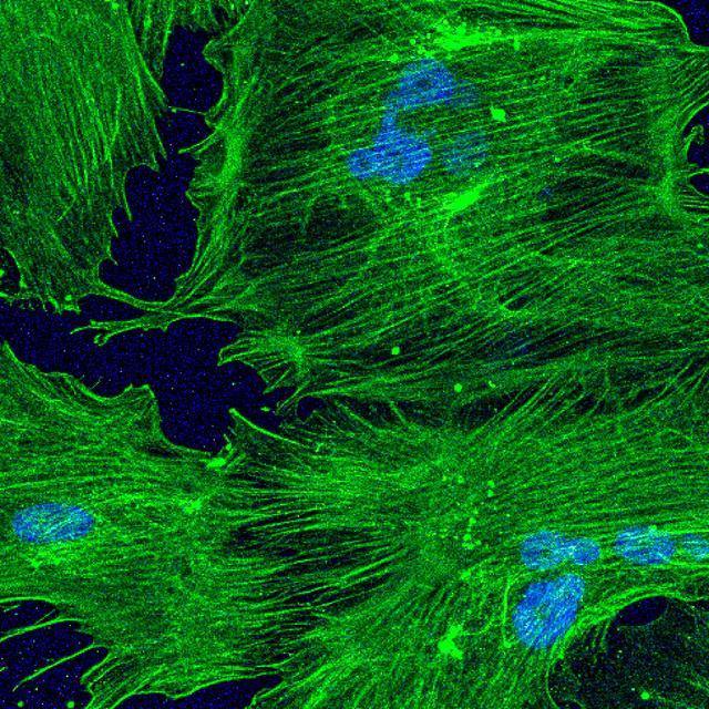 jsc2022e042482 (5/19/2022) --- Image of mesenchymal stromal cells which are essential for bone, wound, and cartilage repair. Image courtesy of Dr. Dong Wang, Transplant and Stem Cell Immunobiology (TSI) Laboratory at UCSF.