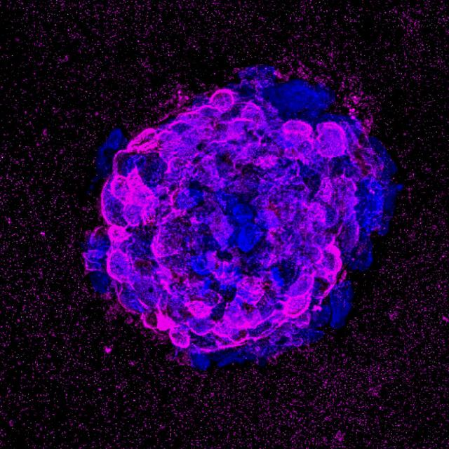 jsc2022e042483 (5/19/2022) --- Image showing impaired wound healing due to immunosenescence. Image courtesy of Prof. Sonja Schrepfer, UCSF.