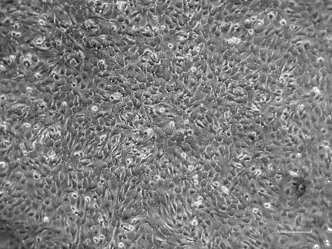 jsc2022e072967 (4/12/2021) --- Image of bovine ovary Granulosa cells. Coordinated by the Italian Space Agency (ASI), OVOSPACE investigates how microgravity influences the maturation and development ovarian cells in mammals, including Granulosa cells. This experiment could help scientists understand how long-term settlement on the Moon or Mars might affect the fertility of astronauts living in reduced gravity for long durations. Image courtesy of Professor Mariano Bizzarri, Department of Experimental Medicine, Sapienza University of Rome.