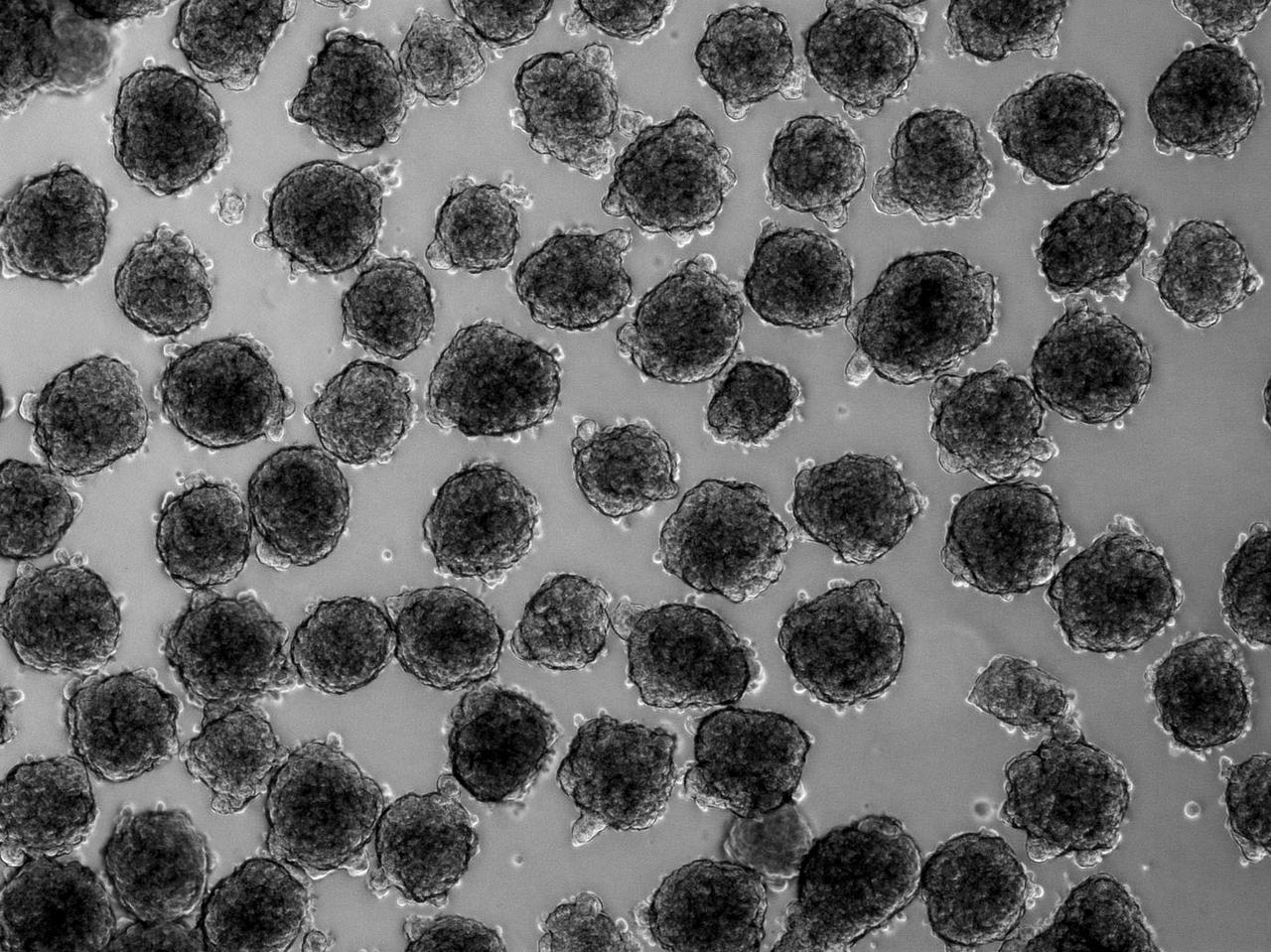 jsc2022e072971 (9/22/2022) --- A preflight view 3D heart cells in suspension culture. ISS: Engineering Stem Cell-Derived Cardiac Microtissues with Metabolic Regulators in Space to Promote Cardiomyocyte Maturation (Project EAGLE) grows 3D cultures of heart cells on the International Space Station. What is learned could help scientists establish a functional heart tissue model that mimics heart disease and can be used to test new drugs. Image courtesy of Parvin Forghani, Ph.D., Emory University.