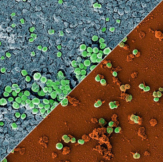 jsc2023e010179 (2/28/2023) --- This image is a composition of two scanning electron microscopic images of the bacterium Staphylococcus capitis on stainless steel versus antimicrobial copper. The image was colored to visualize the bacterial cells (green) either embedded in a biofilm matrix (blue), or covered with copper particles (red/orange). The ESA-Biofilms investigation studies bacterial biofilm formation and antimicrobial properties of different metal surfaces under spaceflight conditions in altered gravity. Both images were taken as part of the preflight experiments for ESA-Biofilms. Image courtesy of DLR, CC BY-NC-ND 3.0.