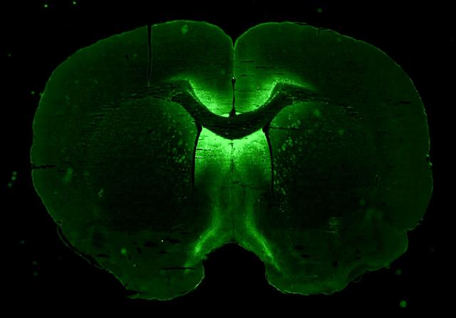 jsc2023e026250 (4/28/2023) --- A preflight vector image of AAV gene therapy that selectively targets neurons to induce axon regeneration. Innovative Paralysis Therapy Enabling Neuroregeneration (Neuronix) demonstrates the formation of three-dimensional neuronal cell cultures in microgravity and tests a neuron-specific gene therapy. Image courtesy of AXONIS Therapeutics, Inc.