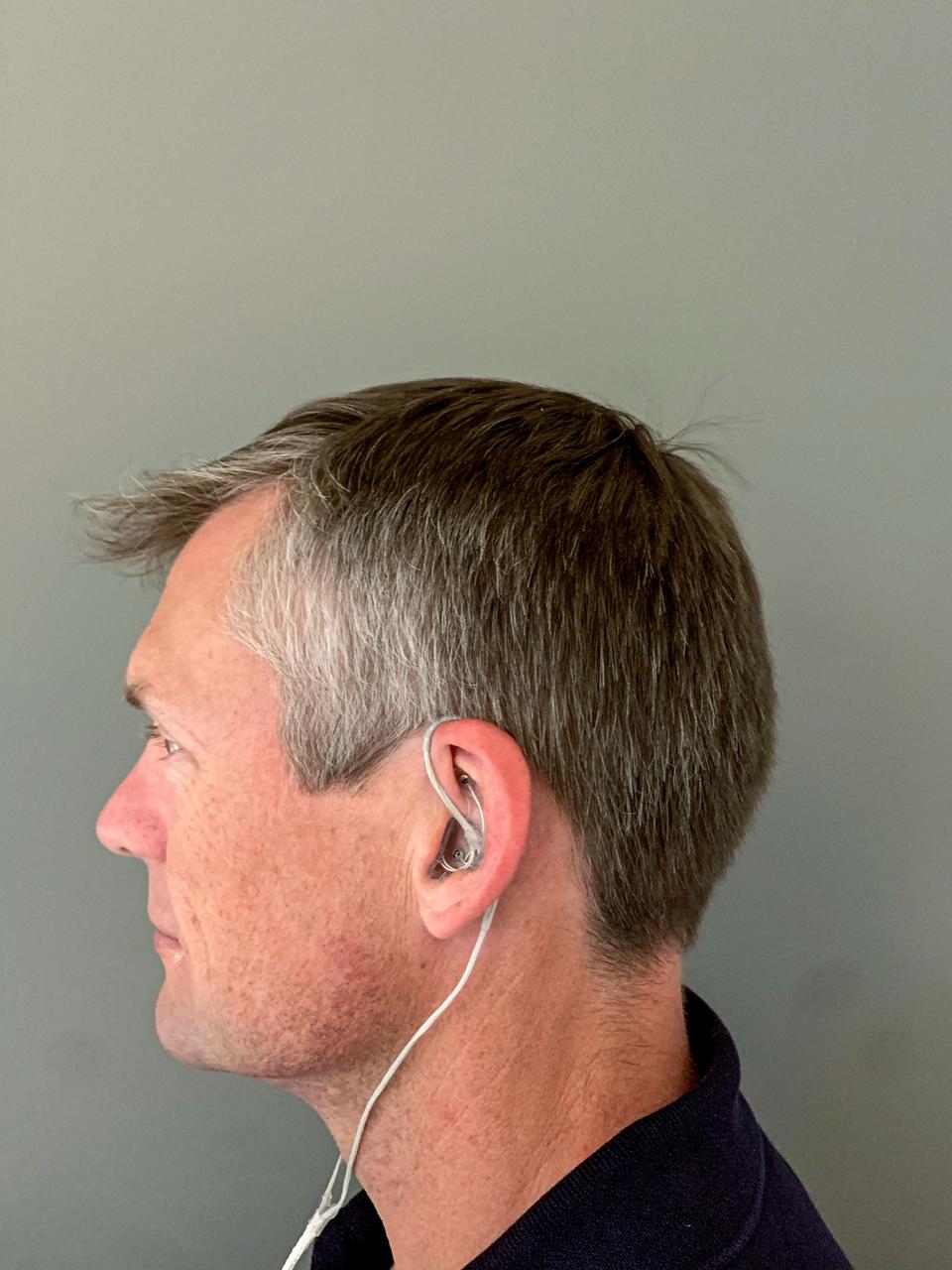 jsc2023e031741 (5/24/2023) --- Long-term Sleep Monitoring Before, During and After Extended Spaceflight (Sleep in Orbit) ear-EEG (electroencephalography) hardware worn by subject. The Sleep in Orbit investigation studies the physiological differences between sleep on Earth and in space using ear-EEG (electroencephalography) based sleep monitoring. Image courtesy of Preben Kidmose.