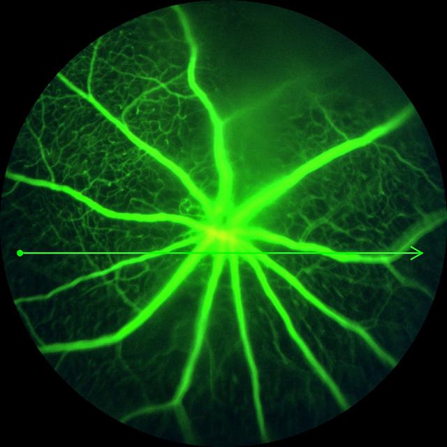 jsc2023e054752 (9/27/2023) --- Fluorescein angiogram of the microvascular circulation of the mouse retina. Preclinical Validation of a Modifier Gene Therapy to Prevent Spaceflight Associated Oxidative Stress and Apoptosis in Microgravity Mouse Model of Dry Macular Degeneration (Rodent Research-28 or RR-28) tests the effect of a gene therapy on retinal structure and function during spaceflight. (Image courtesy Oculogenex Inc.)