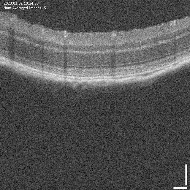 jsc2023e054753 (9/27/2023) --- Optical Coherence tomography image demonstrating the retinal ultrastructure of the mouse retina. Preclinical Validation of a Modifier Gene Therapy to Prevent Spaceflight Associated Oxidative Stress and Apoptosis in Microgravity Mouse Model of Dry Macular Degeneration (Rodent Research-28 or RR-28) tests the effect of a gene therapy on retinal structure and function during spaceflight. (Image courtesy Oculogenex Inc.)