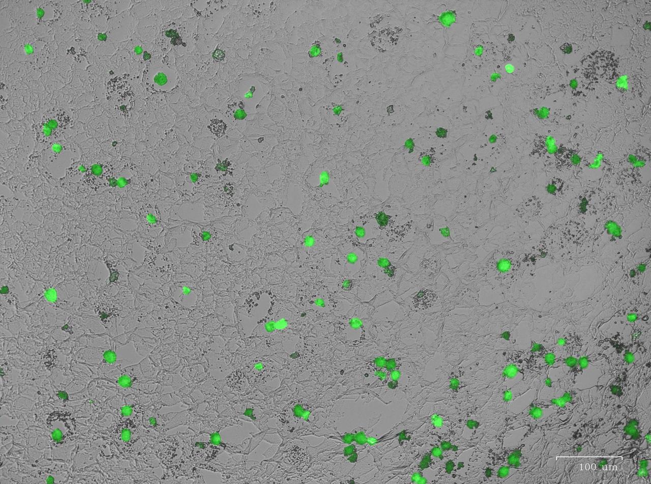 jsc2024e005962 (12/10/2023) --- A preflight image for the Compartment Cartilage Tissue Construct investigation shows that the Janus base Nanopieces (JBNps) delivered green fluorescence labeled therapeutic RNA into cartilage cells. Compartment Cartilage Tissue Construct uses biological materials that mimic DNA to develop a scaffold for regenerating cartilage tissues and tests the effect of a specific RNA on cartilage growth in space. Image courtesy of the University of Connecticut.