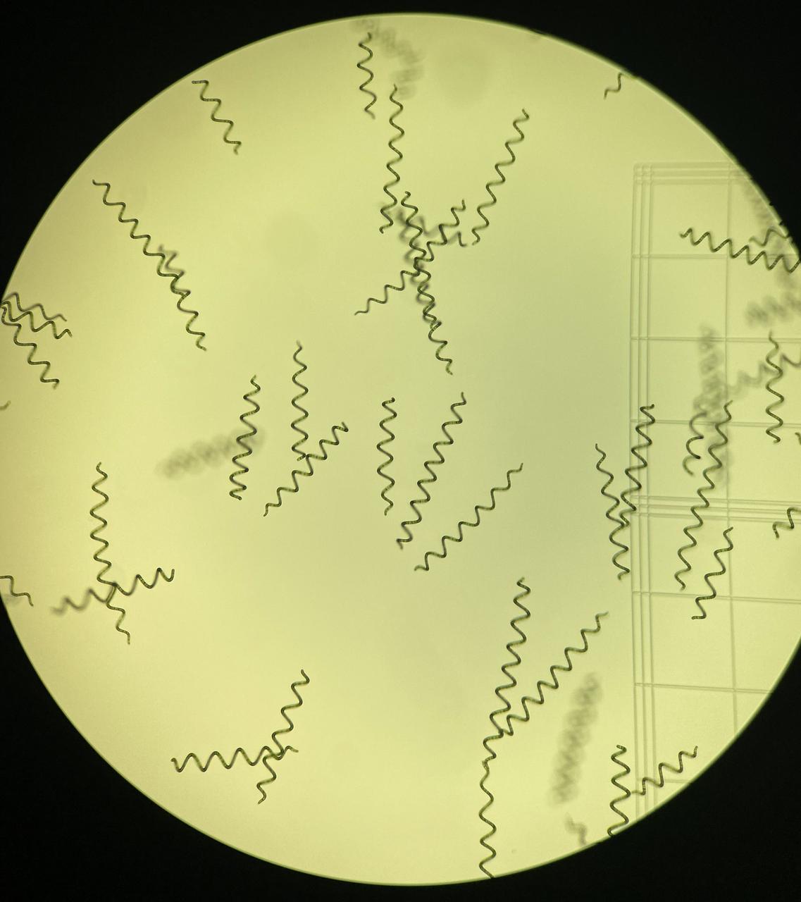 jsc2024e006100 (12/29/2022) --- A. platensis spiral trichomes under a microscope. Image courtesy of Katherine Fisher