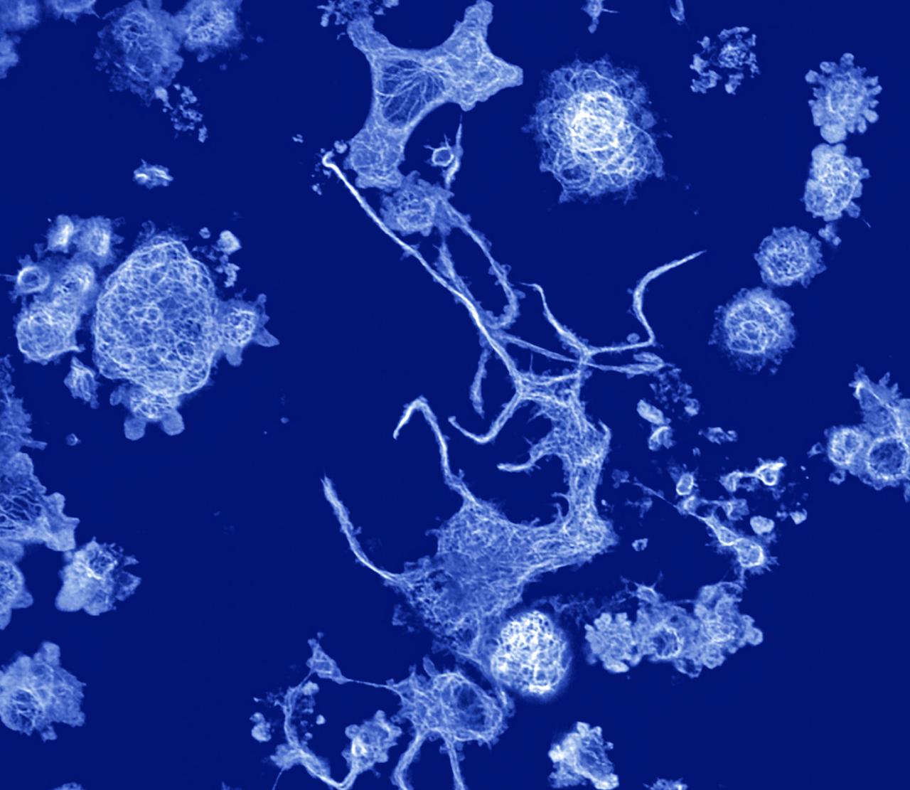 jsc2024e016252 (10/21/2016) --- While in the ISS astronauts’ immune system and clotting capacity undergoes changes during spaceflight, we will be studying how megakaryocytes (depicted in the image), specialized cells functioning in infection responses and blood clotting, are specifically affected during spaceflight and after landing back on earth. This information directly influences the health of future space travelers. (Image taken and processed by Hansjorg Schwertz and Diana Lim, University of Utah)