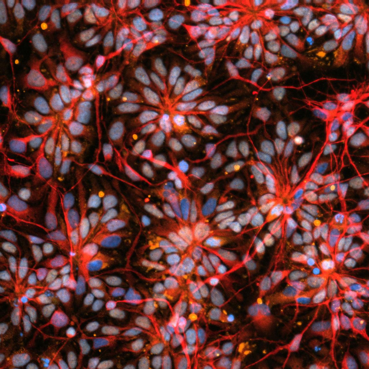 jsc2024e021220 (3/21/2024) --- Precursor cells are shown from the Human Brain Organoid Models for Neurodegenerative Disease & Drug Discovery (HBOND) investigation of primary progressive multiple sclerosis (MS). These Cosmic Brain Organoids will spend approximately 30 days on the International Space Station. This investigation studies 3D neuroglial organoids derived from the induced pluripotent stem cells (IPSCs) of patients with primary progressive MS and Parkinson’s disease. Results may improve understanding of neurodegenerative disease and accelerate the development of new treatments. Image courtesy of the New York Stem Cell Research Institute.