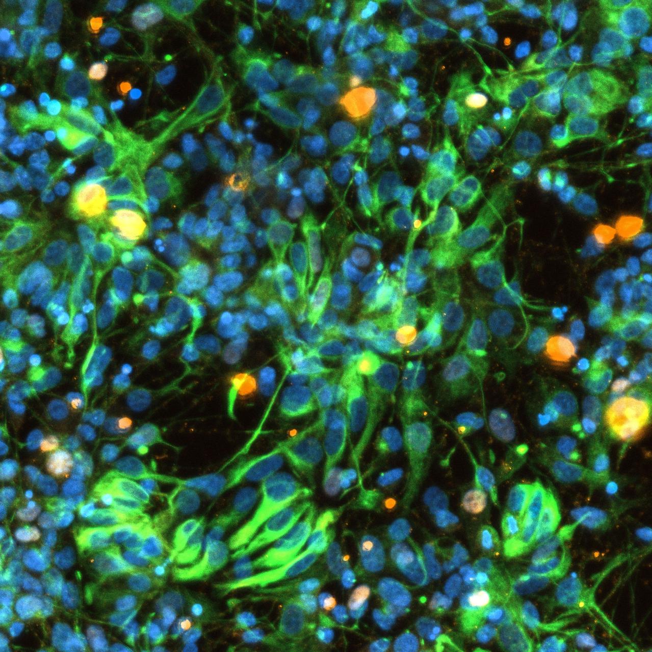 jsc2024e021221 (2/21/2024) --- Precursor cells are shown from the Human Brain Organoid Models for Neurodegenerative Disease & Drug Discovery (HBOND) investigation of Parkinson’s disease. These Cosmic Brain Organoids will spend approximately 30 days on the International Space Station. This investigation studies 3D neuroglial organoids derived from the induced pluripotent stem cells (IPSCs) of patients with Parkinson’s disease and primary progressive multiple sclerosis. Results may improve understanding of neurodegenerative disease and accelerate the development of new treatments. Image courtesy of the New York Stem Cell Research Institute.