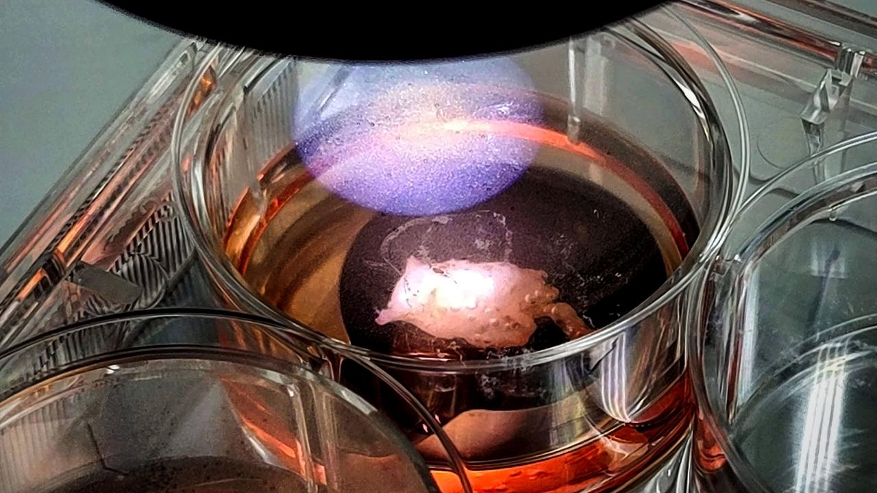 jsc2024e038395 (6/5/2024) --- Live human heart tissue bioprinted with Redwire's BioFabrication Facility aboard the International Space Station. The tissue was successfully returned to Earth in April 2024. Results of the Redwire Cardiac Bioprinting Investigation (BFF-Cardiac) could advance technologies for producing organs and tissues in lieu of donated organs for transplant. The investigation also improves 3D printing, with the goal of giving the crew the ability to print material like foods and medicines on demand for future long-duration space missions. Image courtesy of Redwire.