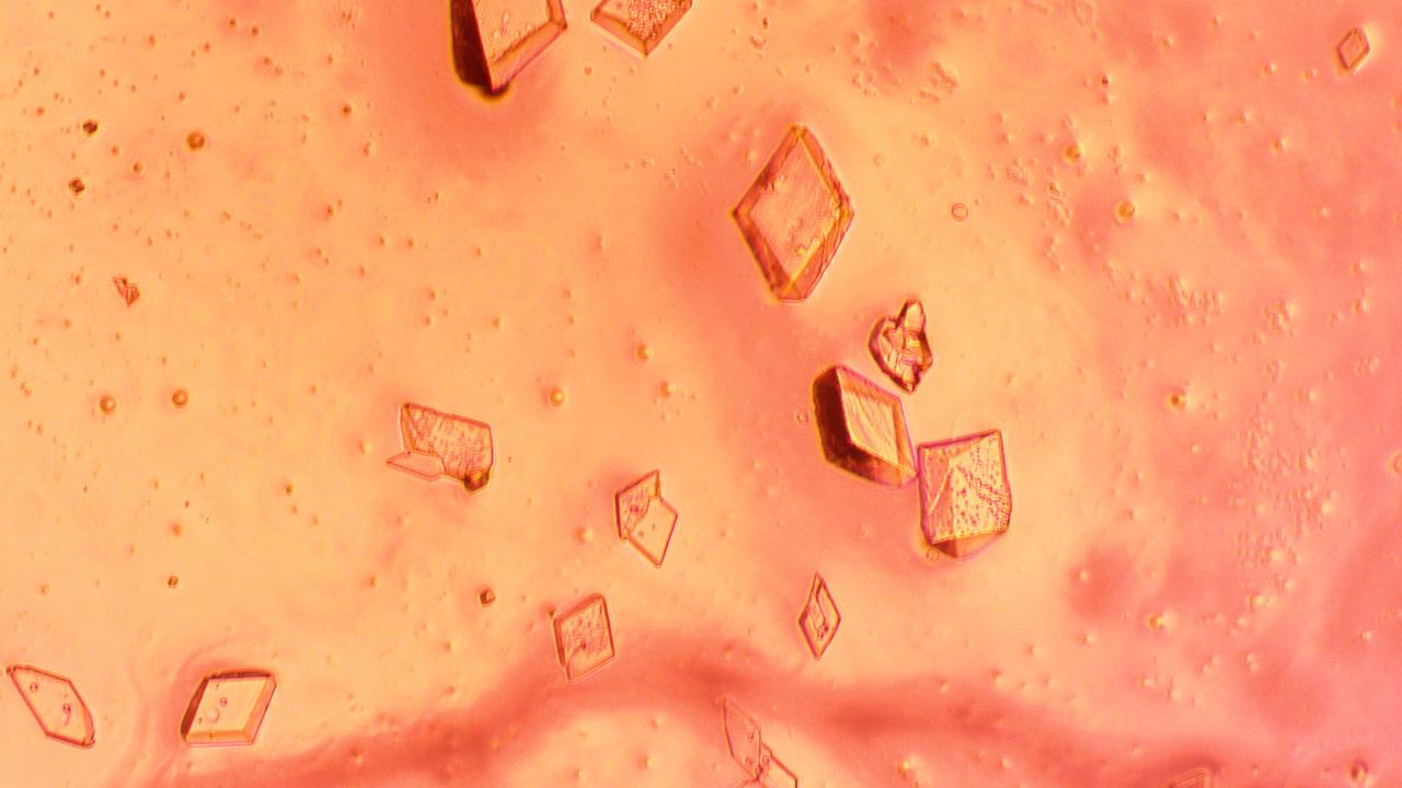 jsc2024e038396 (6/5/2024) --- Insulin crystals grown with Redwire's PIL-BOX aboard the International Space Station. This image was taken after the crystals returned to Earth in April 2024. This control compound helps the body convert food into energy and store it for later use. The ADSEP-PIL-02 investigation aims to study the effect of microgramInsulin crystals grown with Redwire's PIL-BOX aboard the International Space Station. This image was taken after the crystals returned to Earth in April 2024. This control compound helps the body convert food into energy and store it for later use. The In-Space Production Application – Pharmaceutical In-space Laboratory – 02 (InSPA-PIL-02) (ADSEP-PIL-02) investigation aims to study the effect of microgravity on the production of various types of crystals. Image courtesy of Redwire. on the production of various types of crystals. Image courtesy of Redwire.