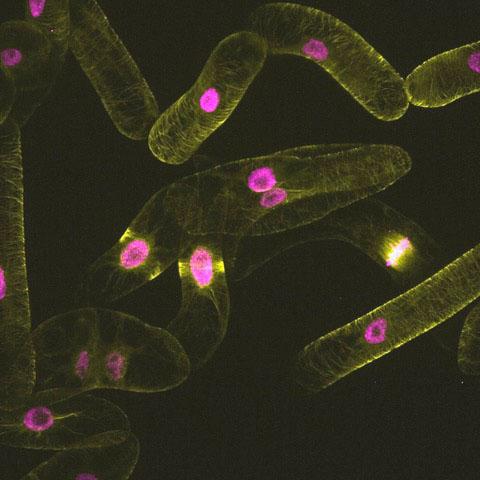 jsc2024e041792 (11/10/2022) --- microtubules and nuclei (yellow: microtubules, magenta: nuclei) for the Effects of the Space Environment on Cell Division in Plants (Plant Cell Division). Image courtesy of University of Toyama.