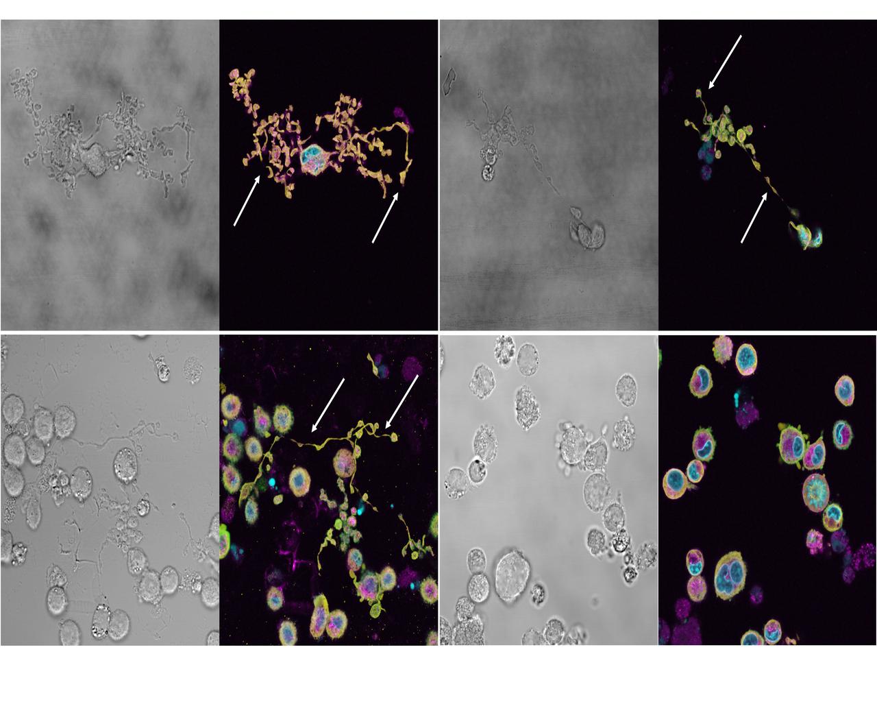 jsc2024e043736 (5/23/2024) --- Preflight ground image of cultured megakaryocytes (precursor cells which produce platelets). The fixed cells were stained using WGA (binding sialic acid, magenta), phalloidin (actin binding, green), beta-tubulin antibody (yellow), and nuclei (DAPI, light blue). Proplatelet extensions, which function as assembly lines for platelets, are highlighted by arrows. Megakaryocytes Orbiting in Outer Space and Near Earth: The MOON Study (Megakaryocyte Flying-One (MeF1)) investigates how environmental conditions affect development and function of platelets and megakaryocytes, cells found in bone marrow. Results could provide clarify the risks of changes in inflammation, immune responses, and clot formation in spaceflight and on the ground. Image courtesy of the NASA Space Radiation Laboratory.