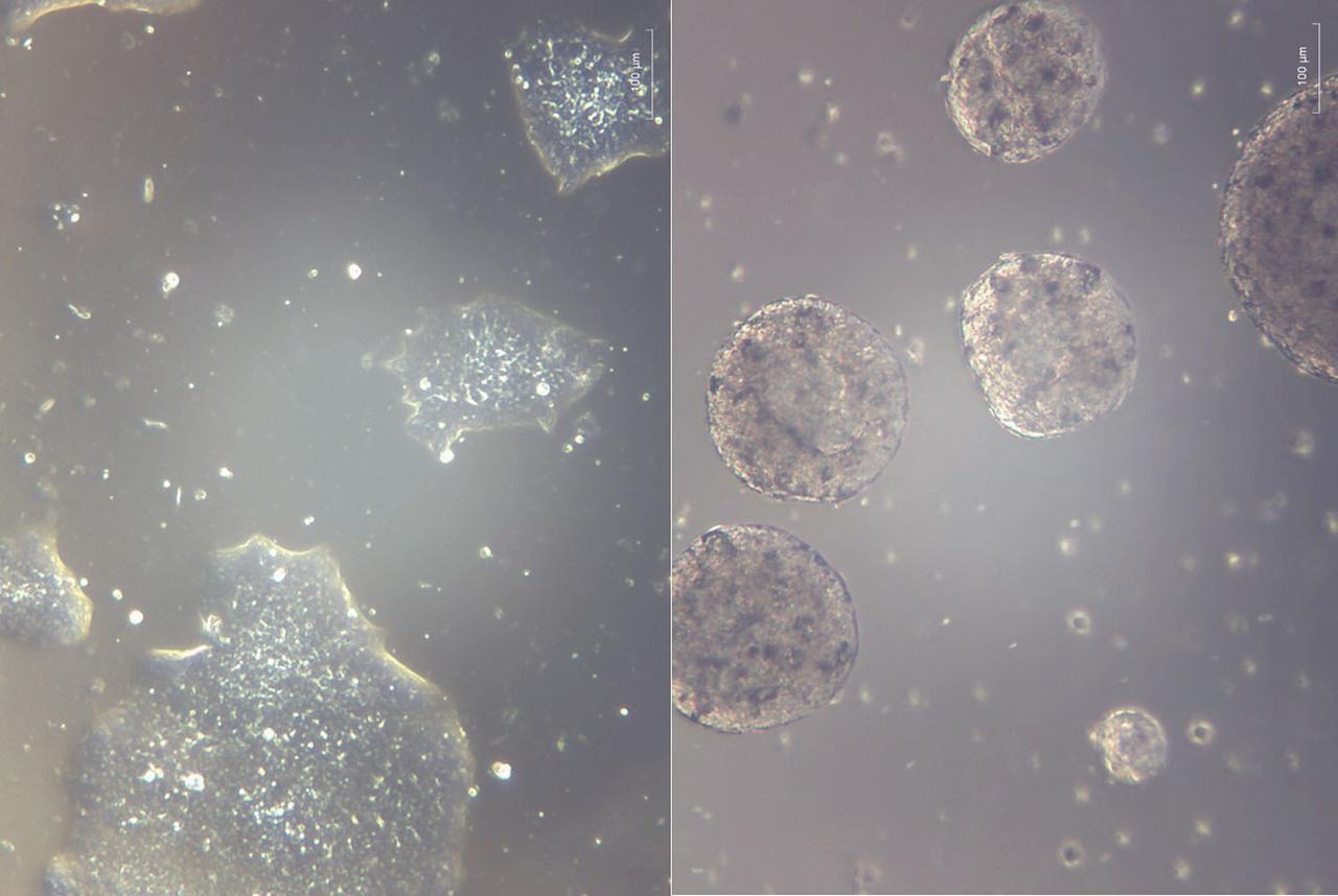 jsc2025e007240 (2/18/2025) ---Induced pluripotent stem cells (iPSCs) grown attached as a mat in 2D on Earth as the current state-of-the-art (left) vs. iPSC experimentally grown as spheres in suspension in 3D bioreactors on Earth in simulated microgravity conditions (right). In-Space Production of Induced Pluripotent Stem Cells for Clinical Application (StemCellEX-IP1) investigation aims to use microgravity to expand and mass-produce high quality human iPSCs. Image courtesy of BioServe.