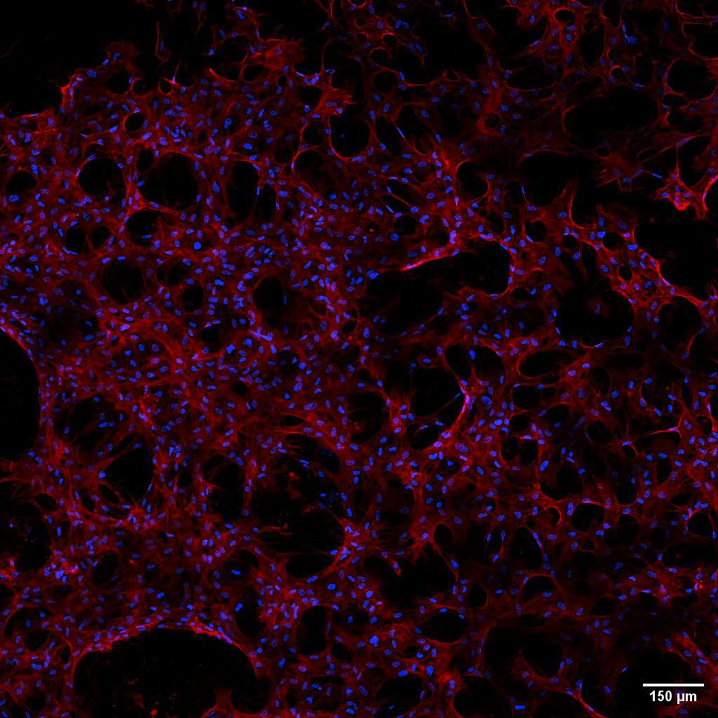 The image shows stem cells embedded within a network of scaffolding material. The scaffold is densely populated with cells adhered throughout.