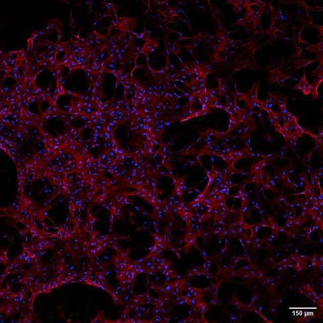 jsc2025e036190 (4/4/2025) --- Stem cells grown along the Janus Base Nanomaterial (JBNm) made aboard the International Space Station. After four hours, a significant increase in the number of these cells adhered to the scaffold, compared to the ground scaffold. This shows that structural improvements were obtained through in-space manufacturing and translated directly into biological improvements. The Flight JBNm is much better at stem cell recruitment, which could better stimulate cartilage regeneration. Biomimetic Fabrication of Multi-Functional DNA-Inspired Nanomaterials via Controlled Self-assembly in Space (DNA Nano Therapeutics-Mission 2) continues prior research on in-space manufacturing of nanomaterials that mimic DNA and have applications for vaccines and regenerative medicine. Image courtesy of University of Connecticut.
