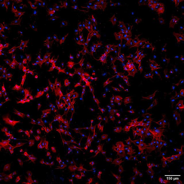 Jsc2025e036192 (4/4/2025) --- Stem cells grown along Janus Base Nanomaterial (JBNm) made on Earth. After four hours, the cells adhered to the scaffold. Biomimetic Fabrication of Multi-Functional DNA-Inspired Nanomaterials via Controlled Self-assembly in Space (DNA Nano Therapeutics-Mission 2) continues prior research on in-space manufacturing of nanomaterials that mimic DNA and have applications for vaccines and regenerative medicine.  Image courtesy of University of Connecticut.
