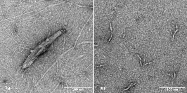 jsc2025e036194 (4/4/2025) --- Image of nanoparticles synthesized under 1g vs microgravity. Left: This transmission electron microscope image depicts the nano-scale structure of Janus Base Nanoparticles encapsulated with mRNA on ground. Right: This is a transmission electron microscope image of mRNA-encapsulated JBNp that was produced on ISS during the SpaceX CRS-31 mission. Here, you can see that the space-made JBNp is smaller and more uniform in size and shape with less background material, demonstrating the stark advantage that in-space manufacturing can provide JBNp: improved uniformity and drug loading. Image courtesy of University of Connecticut.
