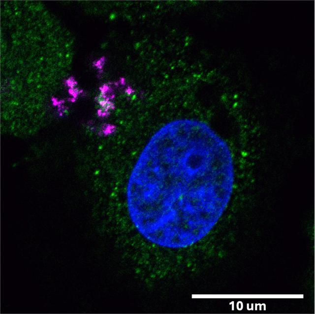 jsc2025e036195 (4/4/2025) --- A confocal microscope image shows a human cartilage cell, with its nucleus stained in blue, following delivery of Janus Base Nanoparticles (JBNp) and the subsequent release of bioactive mRNA (pink) that was translated into function protein (green). Biomimetic Fabrication of Multi-Functional DNA-Inspired Nanomaterials via Controlled Self-assembly in Space (DNA Nano Therapeutics-Mission 2) continues prior research on in-space manufacturing of nanomaterials that mimic DNA and have applications for vaccines and regenerative medicine. Image courtesy of University of Connecticut.