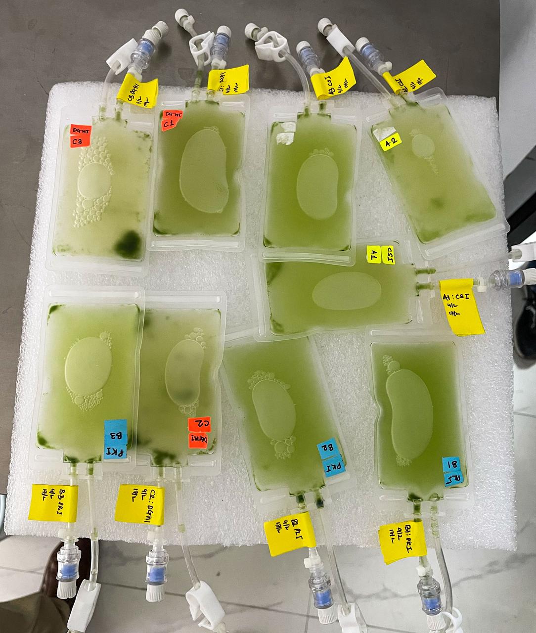 jsc2025e037099 (2/27/2025) --- Cell culture bags are shown filled with microalgae and growth media at the International Centre for Genetic Engineering and Biotechnology (ICGEB). Impact of Microgravity in the ISS on Edible Microalgae (Space Microalgae - ISRO) studies how the environment, microgravity, and increased radiation on the International Space Station affect algae growth and production. Image courtesy of Redwire.Cell culture bags are shown filled with microalgae and growth media at the International Centre for Genetic Engineering and Biotechnology (ICGEB). Impact of Microgravity in the ISS on Edible Microalgae (Space Microalgae - ISRO) studies how the environment, microgravity, and increased radiation on the International Space Station affect algae growth and production. Image courtesy of Redwire.