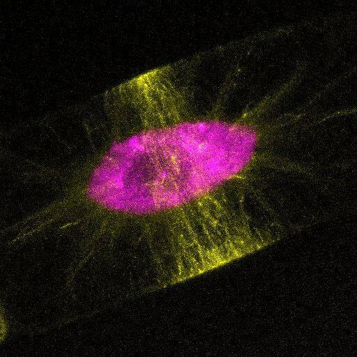 jsc2025e047405 (5/28/2025) ---  Image of the preparative zone of cultured tobacco cells with visualized microtubules (yellow: microtubules [preparative zone], magenta: nuclei). For the Effects of the Space Environment on Cell Division in Plants (Plant Cell Division) investigation, plant samples are collected that are fixed and frozen for analysis of microstructures, microtubules, proteomes, and transcriptome and imaged using the JAXA Confocal Microscope (COSMIC). The Plant Cell Division investigation provides researchers with a better understanding of how gravity affects the body plan of plants could support production of food crops on future spaceflight missions. Image courtesy of University of Toyama.