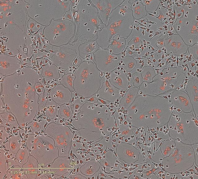 NASA image: PRO Imagery Submittal - Microgravity Associated Bone Loss-B (MABL-B)