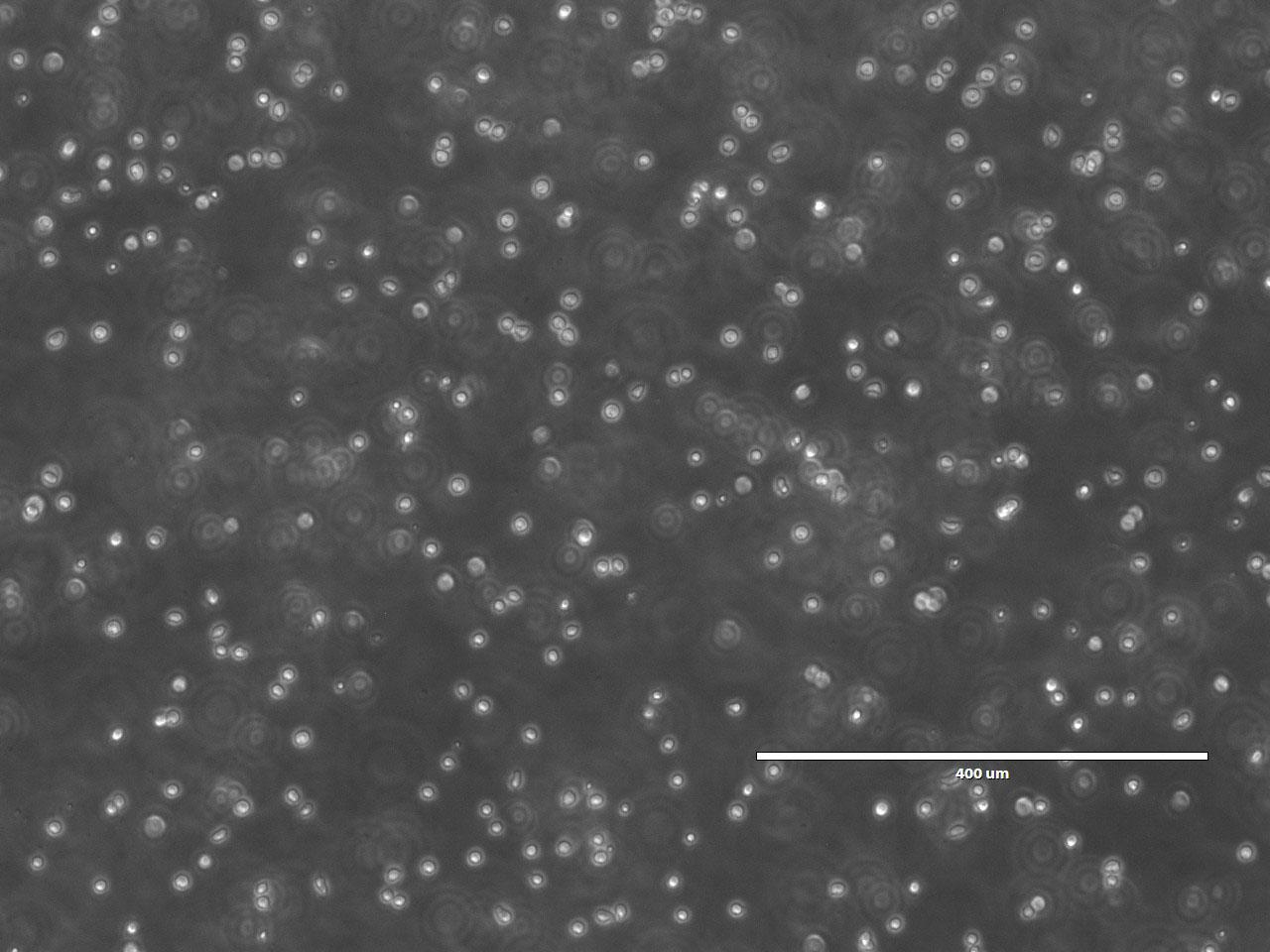 jsc2026e014322 (March 23, 2026) --- Preflight microscopic image (10X) of hematopoietic stem cells in culture as part of the InSPA-StemCellEX-H2 investigation, which works upon prior research to produce stem cells in greater numbers in space with BioServe’s newly developed microgravity bioreactor. Credit: Mayo Clinic.