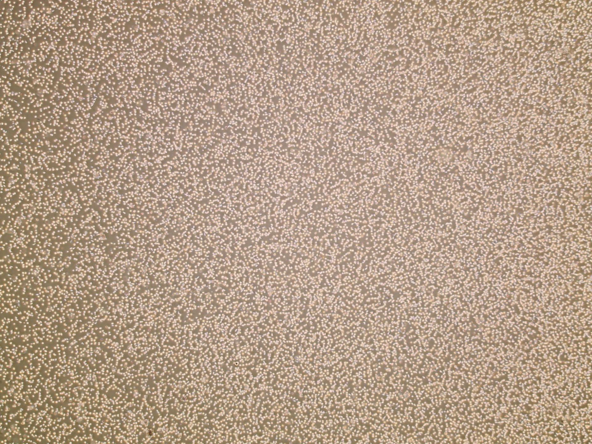 jsc2026e014323 (March 23, 2026) --- Preflight microscopic image (4X) of hematopoietic stem cells in culture at high confluency as part of InSPA-StemCellEX-H2 investigation, which works upon prior research to produce stem cells in greater numbers in space with BioServe’s newly developed microgravity bioreactor. Credit. Mayo Clinic.