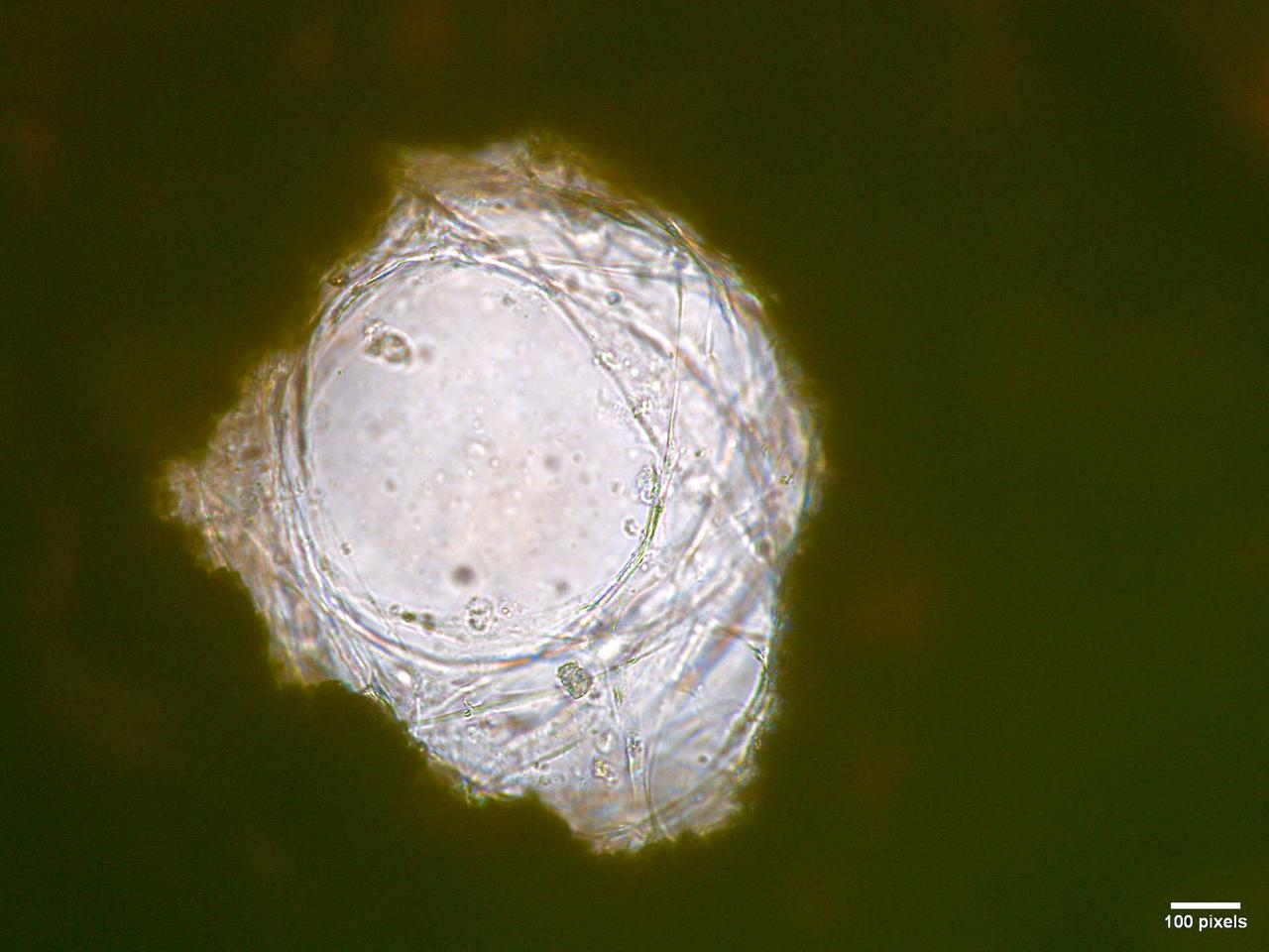jsc2026e017237 (March 27, 2026) --- Microscopic view showing human mesenchymal stem cells (hMSCs) adhered inside one of the pores of a b.Bone scaffold as part of preflight testing for Green Bone. This investigation studies the performance of a biomimetic bone scaffold, b Bone, in microgravity aboard the International Space Station. The image highlights cellular attachment and interaction with the porous structure. A scale bar is visible in the bottom right corner, indicating 100 pixels. Credit:. DIMES Laboratory.