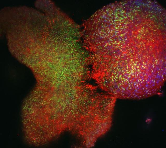 jsc2026e402755 (July 28, 2026) --- A preflight image of a brain organoid immunostained for different neural-specific markers. This laboratory technique is used as part of the Stellar Stem Cells Mission 3 investigation, which aims to produce stem cell clusters, known as organoids, aboard the International Space Station to support cell-based therapies, disease modeling, and drug testing platforms. This could lead to better treatments for conditions like heart disease, stroke, ALS, and Parkinson's Disease. Credit: Cedars-Sinai.