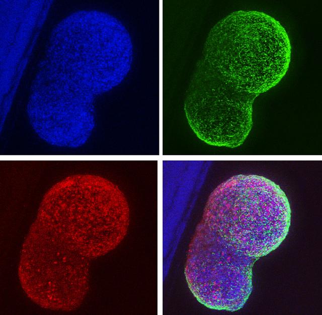 jsc2026e402756 (July 28, 2026) --- A preflight image of a brain organoid immunostained for different neural-specific markers. This laboratory technique is used as part of the Stellar Stem Cells Mission 3 investigation, which aims to produce stem cell clusters, known as organoids, aboard the International Space Station to support cell-based therapies, disease modeling, and drug testing platforms. This could lead to better treatments for conditions like heart disease, stroke, ALS, and Parkinson's Disease. Credit: Cedars-Sinai.