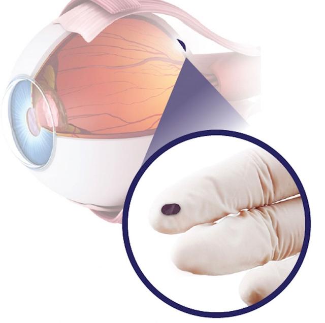 jsc2026e416052 (September 15, 2026) --- Preflight image of LambdaVision-1’s artificial retina alongside a graphic illustrating where the implant is to be placed. This investigation demonstrates optimized flight hardware, successful layering of artificial retinas, and the production of several thin films to compare how they form in terrestrial versus microgravity conditions. Investigation results could refine manufacturing approaches for next generation retinal implants and support technologies aimed at restoring vision for patients with degenerative eye diseases. Credit: LambdaVision.