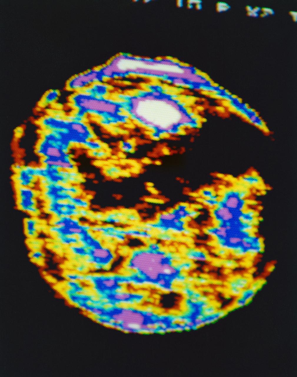 S73-32883 (20 Aug. 1973) --- This false color isophote, processed from an Aug. 20, 1973 television transmission of Apollo Telescope Mount (ATM) experiments from Skylab 3, dramatically reveals a significant change in the coronal hole as compared to the previous day. Solar rotation accounts for the new location of the coronal hole. Photo credit: NASA