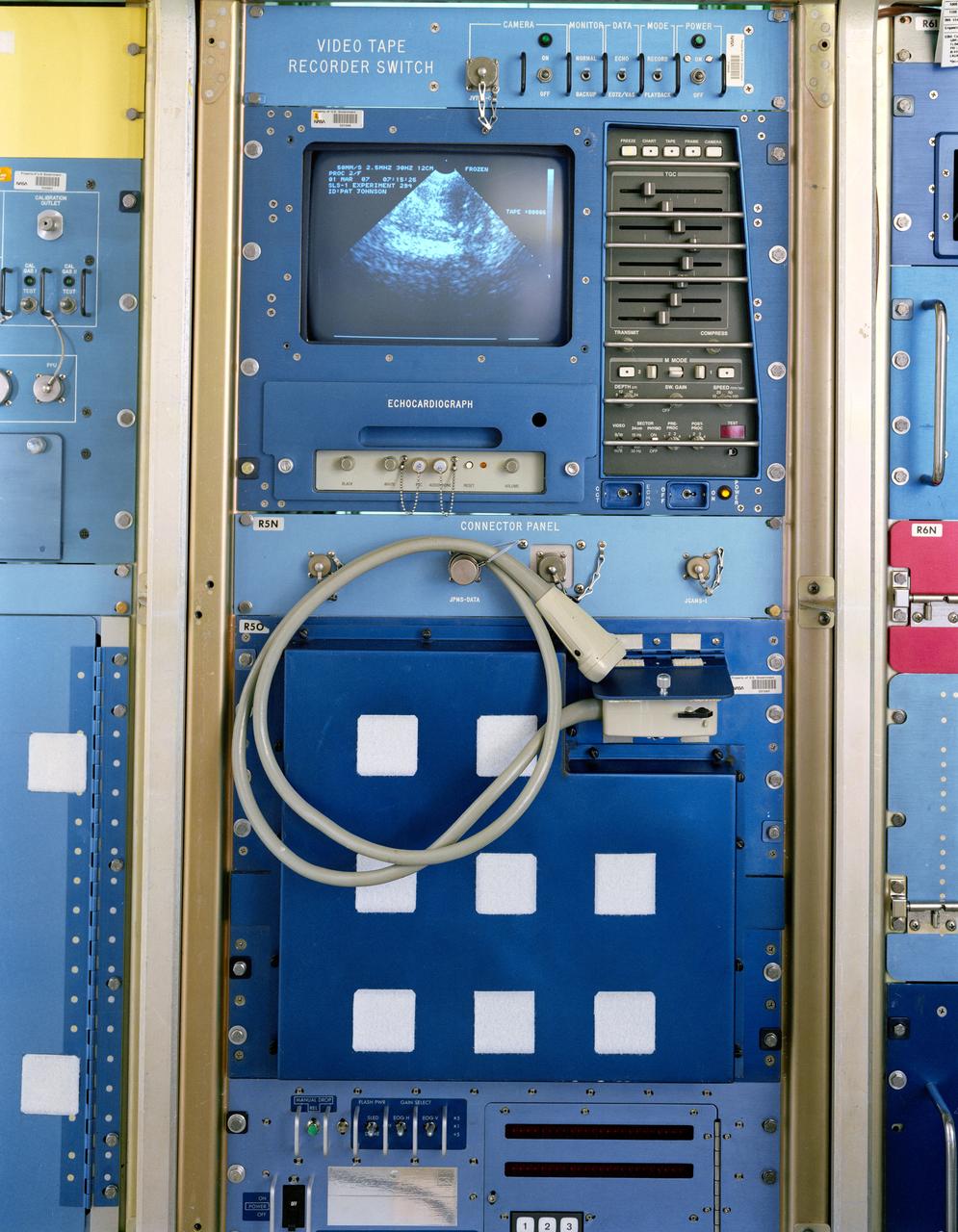 S87-28936 (March 1987) --- The Spacelab Life Sciences-1 (SLS-1) echocardiograph, installed in a science module rack, displays the image of a human heart.  One of the objectives on SLS-1 is the investigation of the effects of microgravity on heart size and function.